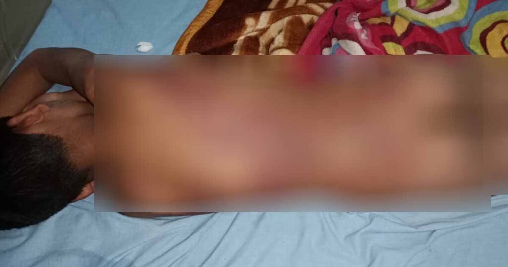 beating of a student in Andh udyog school