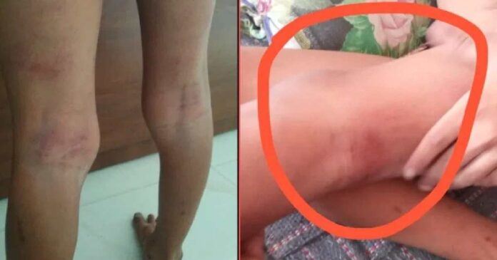 teacher beaten up student in Chandlodia